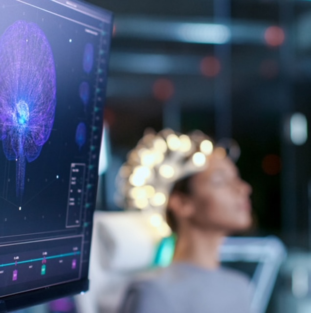 qEEG brain map visualization